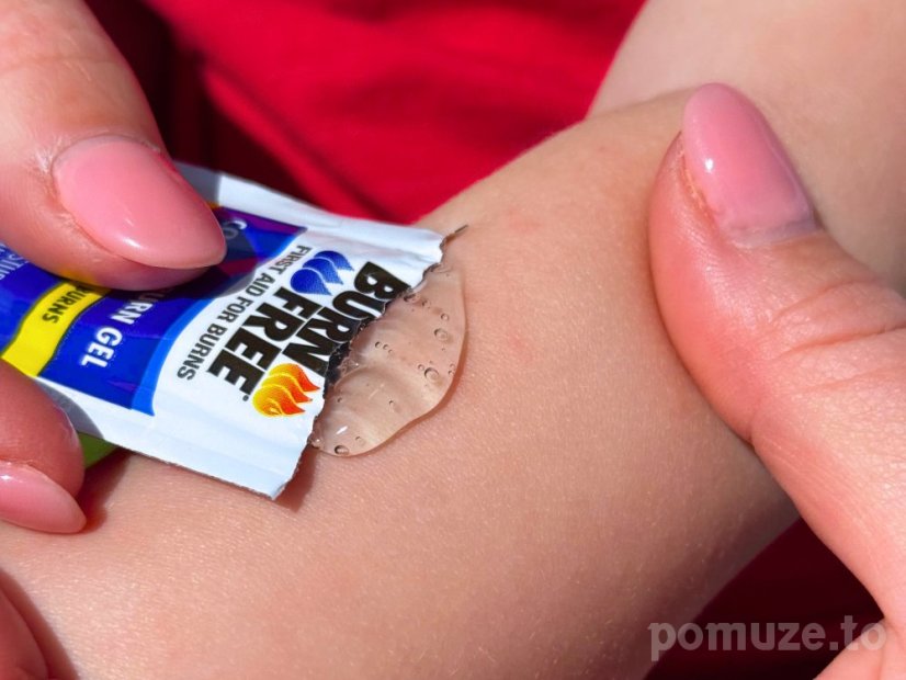 Gel na popáleniny