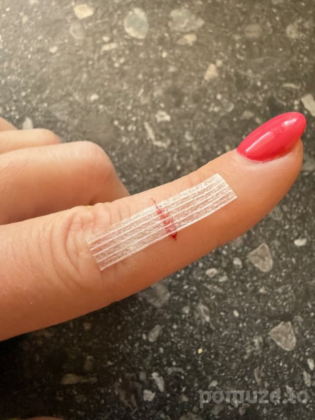 Steri-Strip – náplasťové stehy